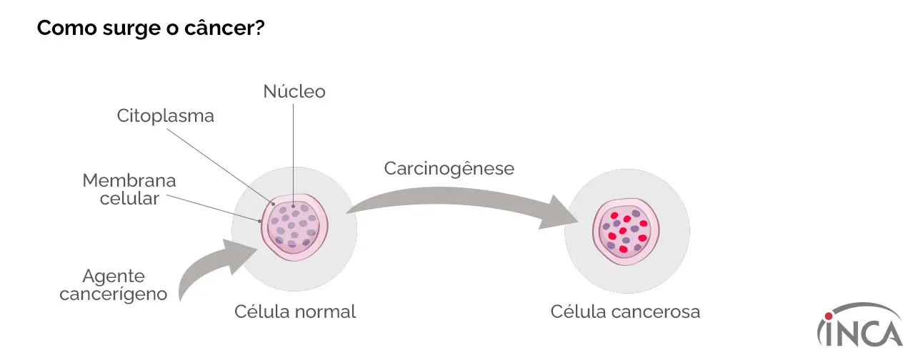O processo de formação do câncer é chamado de carcinogênese ou oncogênese (por isso, oncologista é o especialista) | Reprodução/Inca