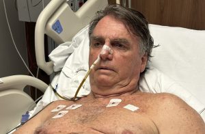 Bolsonaro - recuperação 20-04-25
