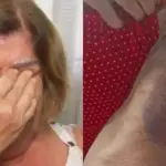 Depois de apanhar de aluno e de padrasto, professora Célia Regina, de 65 anos, deixou de sair de casa: recuperação física e mental | Foto: Reprodução/Redes sociais