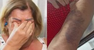 Depois de apanhar de aluno e de padrasto, professora Célia Regina, de 65 anos, deixou de sair de casa: recuperação física e mental | Foto: Reprodução/Redes sociais