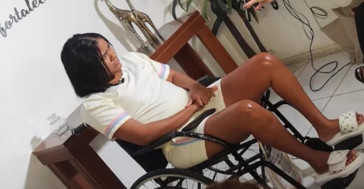 Cega, surda e sem movimentos: mulher relata sequelas depois de cirurgia para colocar silicone