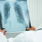 Médica examina imagem de pulmão de paciente: pesquisa pode assegurar ganho de eficiência em tratamento com menor efeito colateral | Foto: Divulgação/Agência SP