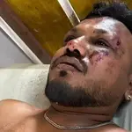 Vishwash Kumar Ramesh, britânico de 40 anos, é o único sobrevivente do acidente na Índia | Foto: Reprodução/Redes sociais