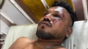 Vishwash Kumar Ramesh, britânico de 40 anos, é o único sobrevivente do acidente na Índia | Foto: Reprodução/Redes sociais