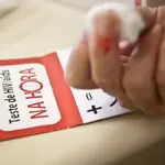 Depois do escândalo em 2024, Ministério da Saúde tenta reafirmar seu rigor na segurança dos testes para HIV | Foto: Marcelo Camargo/Agência Brasil
