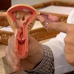 Endometriose: diagnóstico da doença cresceu 30% entre 2022 e 2024 | Foto: Reprodução/TV Brasil