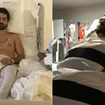 bruno drummond de freitas - medicamento com proteína da placenta - tetraplégicos