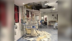 hospital recife pernambuco acidente teto desabamento uti