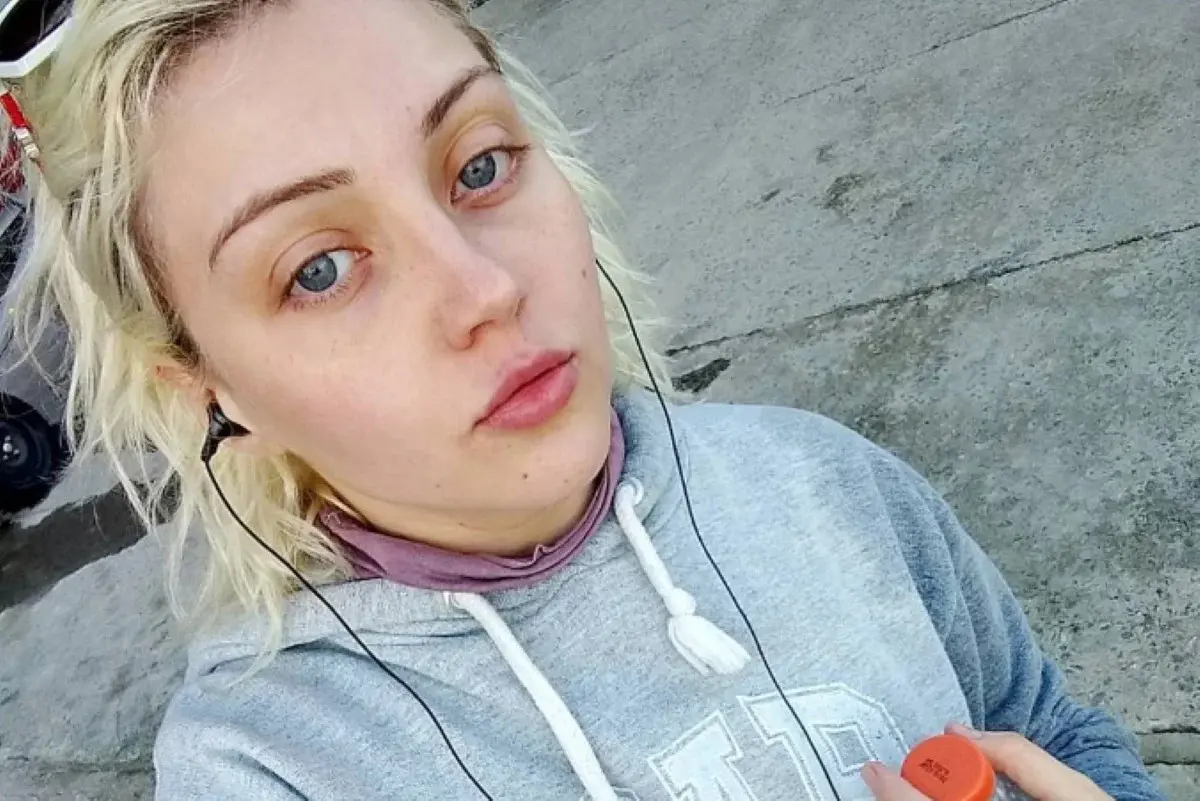 Bárbara Jankavski, a 'Barbie humana'; os investigadores aguardam os resultados dos exames necroscópico e toxicológico | Foto: Reprodução/Redes sociais