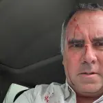Pré-candidato à presidência do Peru sobrevive a ataque a tiros