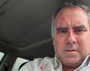 Pré-candidato à presidência do Peru sobrevive a ataque a tiros