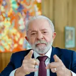 Depois do direito, em 2020, agora é a vez de Lula operar o olho esquerdo | Foto: Divulgação/PR