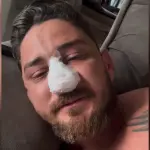 turista porto de galinhas pernambuco agressão praia