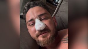 turista porto de galinhas pernambuco agressão praia