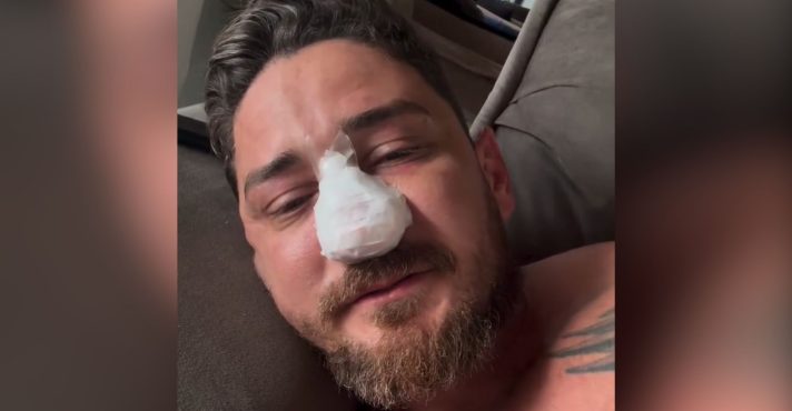 turista porto de galinhas pernambuco agressão praia