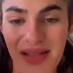 trans x prefeitura de ermo