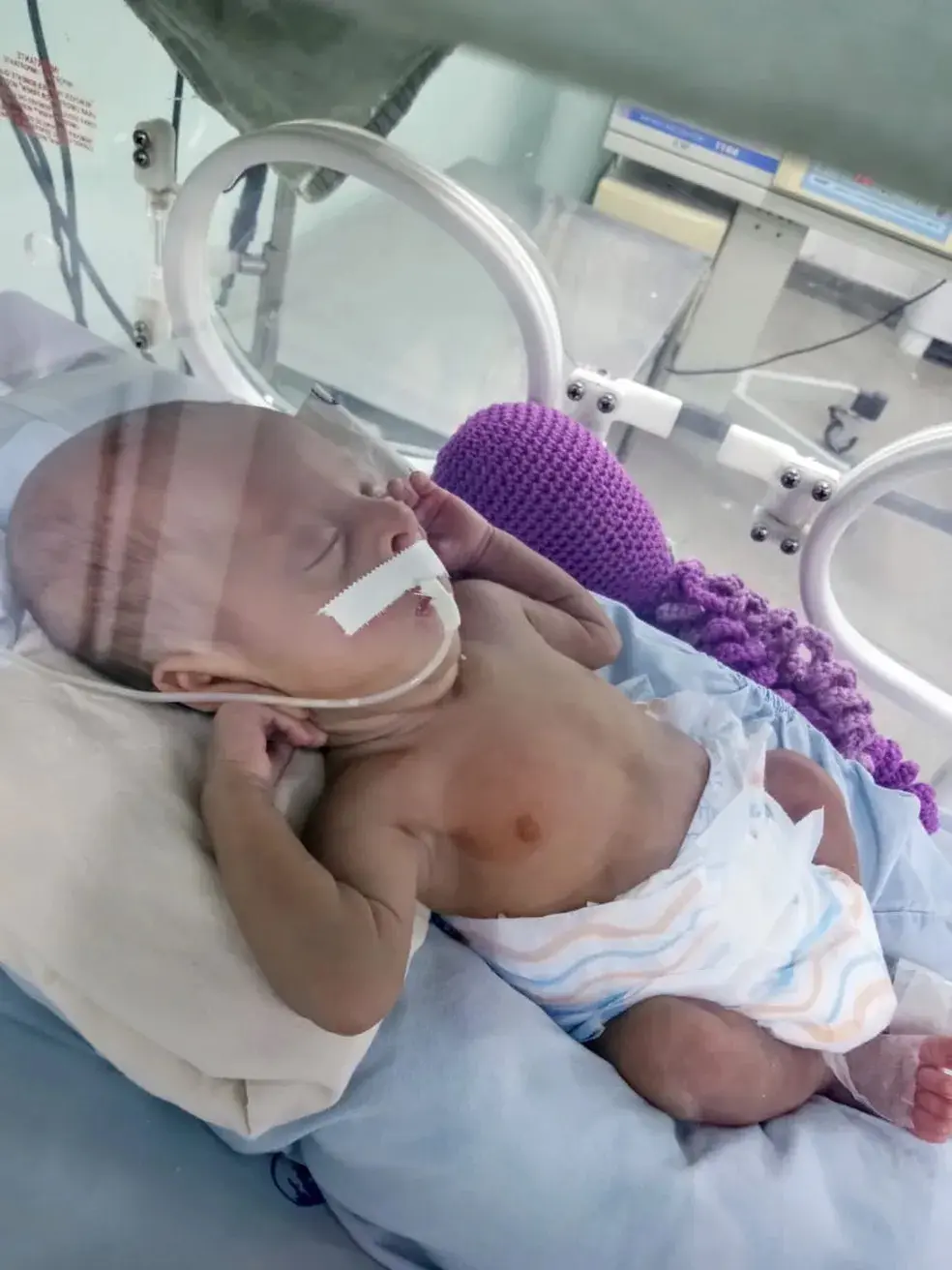 STJ invalida provas e tranca ação penal sobre aborto de bebê de 5 meses