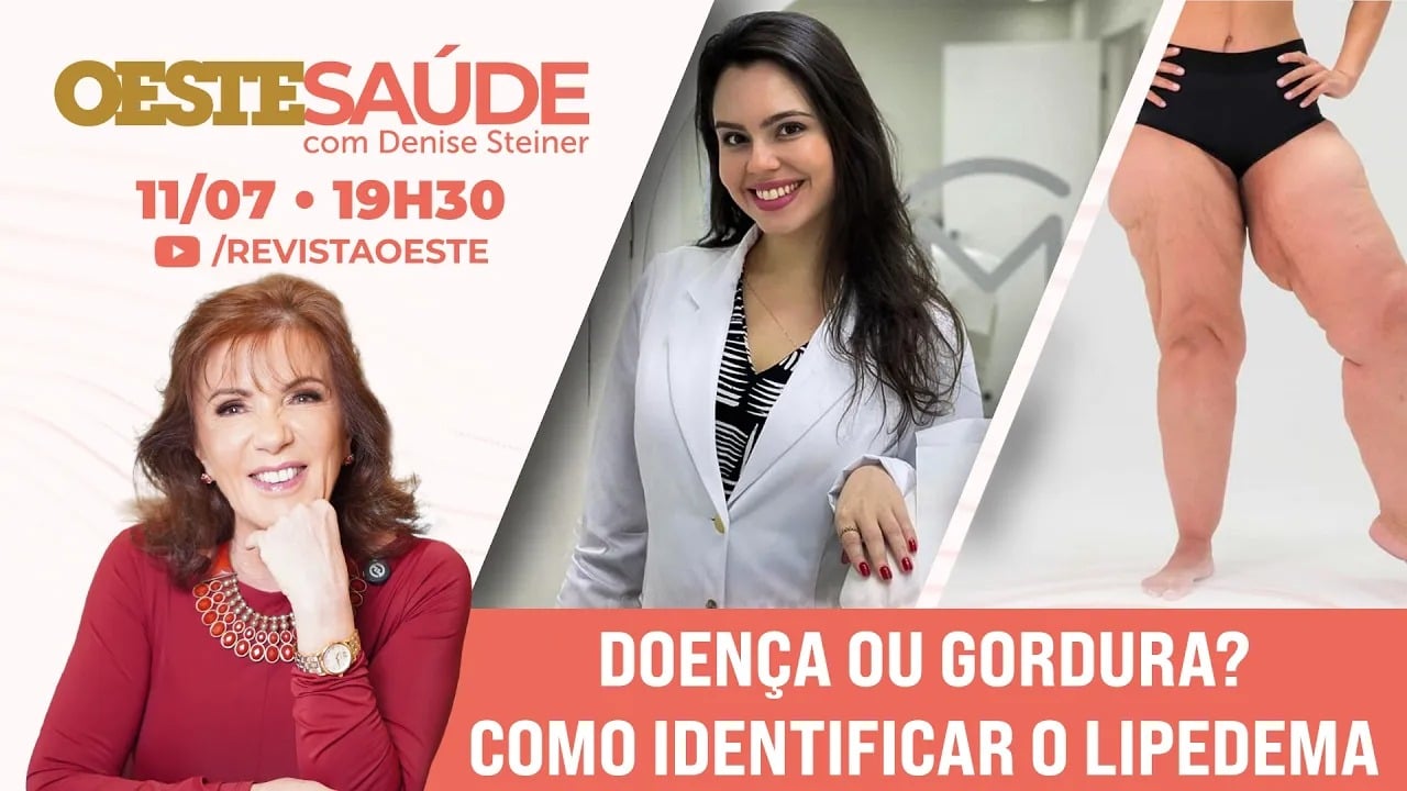 Lipedema: doença ou gordura? Programa 'Oeste Saúde' debate o tema neste sábado